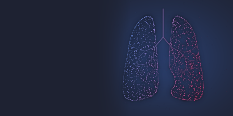 Lung Cancer Update visual 3000x1500